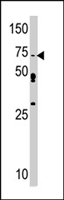 PAB4560 - SRPK1
