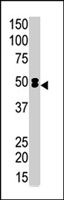 PAB4561 - PDK1