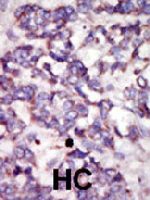 PAB4562 - PDK2