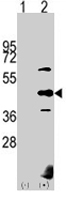 PAB4562 - PDK2