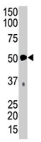 PAB4564 - PDK4