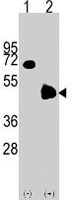 PAB4564 - PDK4