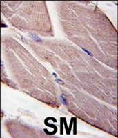 PAB4565 - PDK4