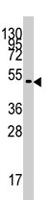 PAB4566 - PDK4