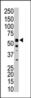 PAB4573 - PKLR