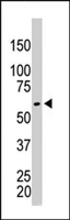 PAB4574 - PKM2