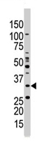 PAB4575 - AMPK beta-1 chain / AMPKb