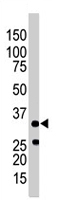 PAB4575 - AMPK beta-1 chain / AMPKb