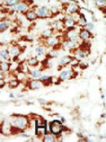 PAB4575 - AMPK beta-1 chain / AMPKb