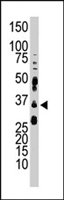 PAB4576 - AMPK beta-2 chain / PRKAB2