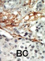 PAB4576 - AMPK beta-2 chain / PRKAB2