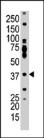 PAB4579 - AMPK gamma-1 chain / AMPKg