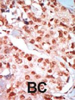 PAB4579 - AMPK gamma-1 chain / AMPKg