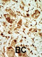 PAB4581 - AMPK gamma-3 chain / AMPKG3