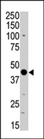PAB4582 - PRKAR2A
