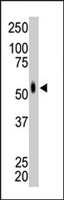 PAB4593 - MKNK2