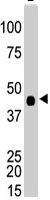 PAB4594 - CKBB