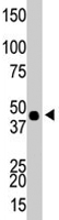 PAB4595 - CKBB