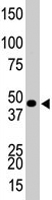 PAB4595 - CKBB
