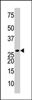 PAB4597 - Thymidylate kinase