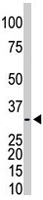 PAB4598 - PRPS1