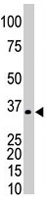 PAB4598 - PRPS1