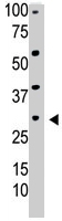 PAB4599 - Thymidine kinase 2 (TK2)