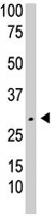 PAB4599 - Thymidine kinase 2 (TK2)