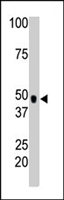 PAB4602 - Choline kinase alpha