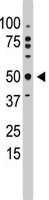 PAB4608 - Ethanolamine kinase 1