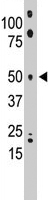PAB4608 - Ethanolamine kinase 1