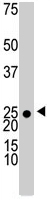 PAB4610 - Ketohexokinase