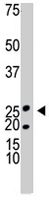PAB4610 - Ketohexokinase