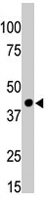 PAB4614 - CKMT