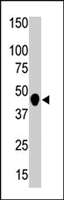 PAB4616 - CKMT2