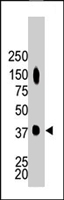 PAB4618 - CKMM
