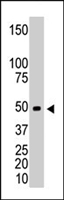 PAB4619 - CKMM