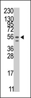 PAB4620 - STK38