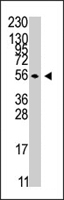 PAB4620 - STK38