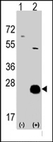 PAB4624 - Casein kinase II beta