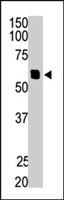 PAB4628 - Integrin-linked protein kinase