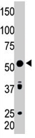 PAB4632 - PICK1