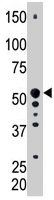 PAB4632 - PICK1