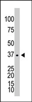 PAB4637 - Galactokinase 1