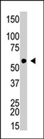 PAB4642 - FAST kinase