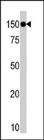 PAB4643 - TAO Kinase 1 (TAOK1)