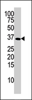 PAB4644 - Deoxyguanosine kinase