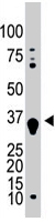 PAB4645 - Deoxyguanosine kinase
