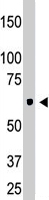 PAB4648 - Ceramide Kinase