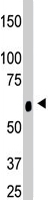 PAB4648 - Ceramide Kinase